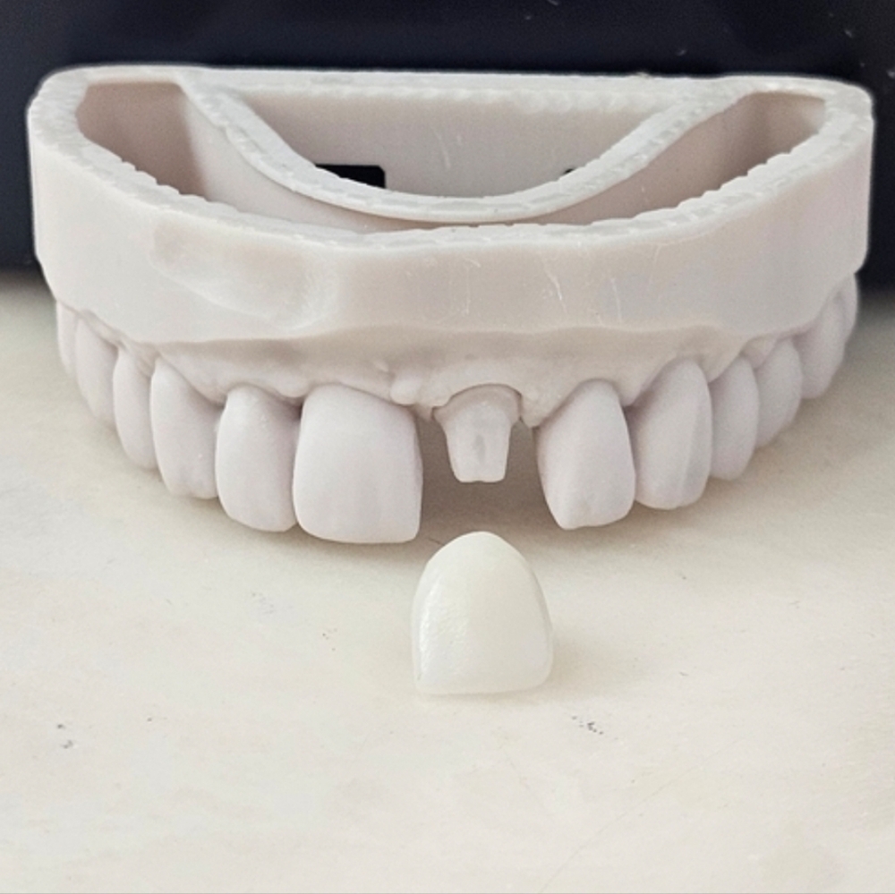 3D Printed Dental Teeth Mold With Crown